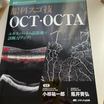 안과 스고기 OCT OCTA 전문가의 판독술로 진단력 업!