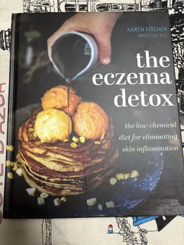 the eczema detox by Karen Fischer