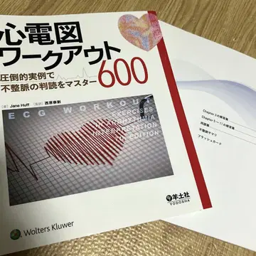 심전도 워크아웃 600 압도적인 실례로 부정맥 판독을 마스터
