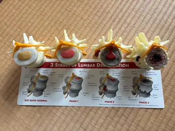3 STAGES OF DEVELOPMENT 피규어 세트