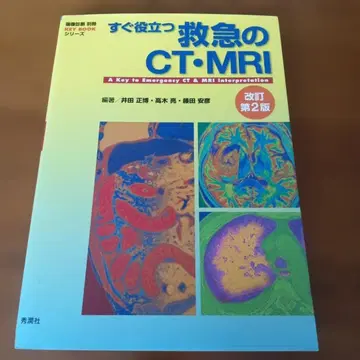 바로 활용하는 응급 CT MRI