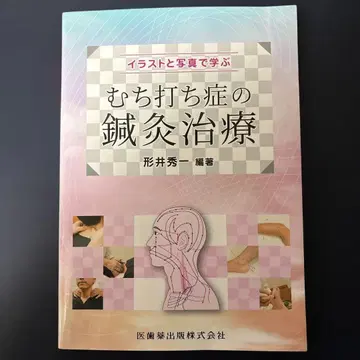 편타성 손상의 침 치료