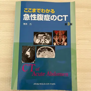 미사용품*여기까지 아는 급성 복증의 CT 제3판