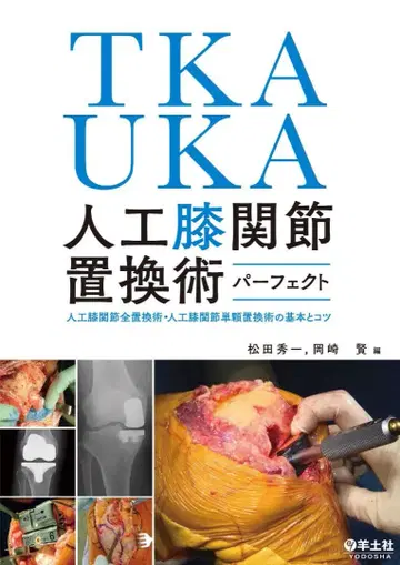 TKA UKA 인공 슬관절 치환술 퍼펙트 ( 재단 완료 )