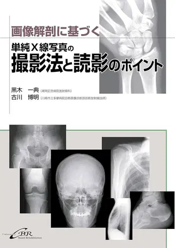 단순 X선 사진 촬영법과 판독 포인트 재단 완료