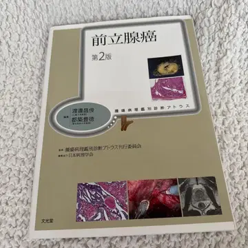 [재단 완료] 전립선암