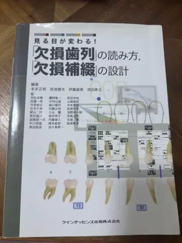 보는 눈이 달라진다! 결손치열 읽는 법