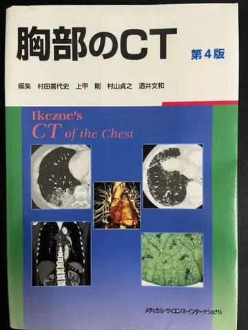 흉부 CT 제4판
