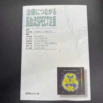 치료로 이어지는 뇌혈류 SPECT 정량