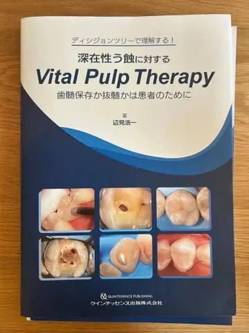 [재단 완료] 심재성 치아 우식에 대한 Vital Pulp Therapy