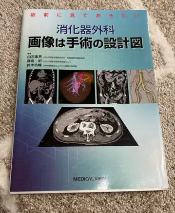 소화기외과 이미지는 수술의 설계도