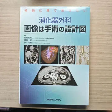 소화기외과 이미지는 수술의 설계도 재단 완료