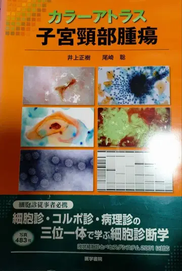 [재단 완료] 컬러 아틀라스 자궁경부 종양