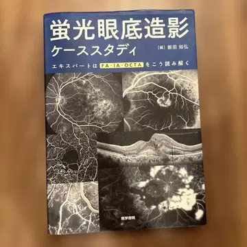 형광 안저 촬영 증례 연구