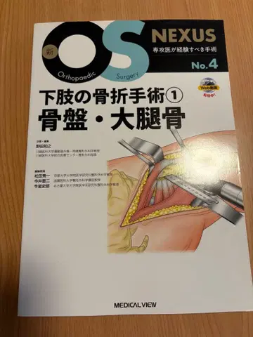 OS NEXUS 하지 골절 수술 1