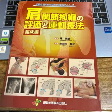 어깨 관절 구축 평가와 운동 요법 임상편