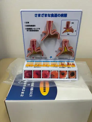 식도와 위 질환 모형 미사용 새상품 박스 포함