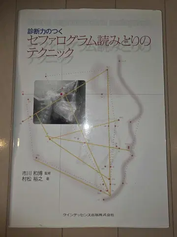 진단력이 붙는 세구로 프로그램 읽어내기 테크닉 재단됨