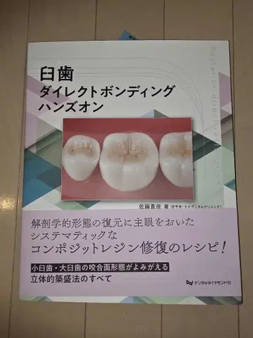 화이트 치아 다이렉트 본딩 핸즈온 재단 완료