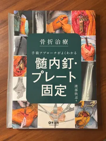 골절 치료 수술 접근법을 잘 알 수 있는 금속정 플레이트 고정 재단됨