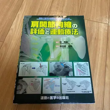어깨 관절 구축의 평가와 운동 요법