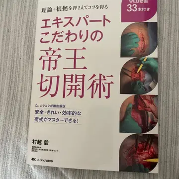 전문가의 고집스러운 제왕절개술