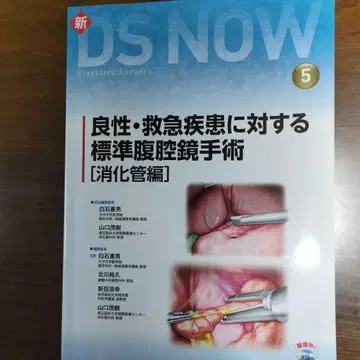 양성 응급 질환에 대한 표준 복강경 수술 소화관 편