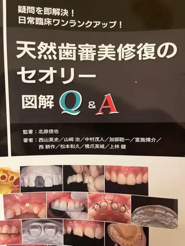 천연치 심미 복원의 띠어리 Q&A