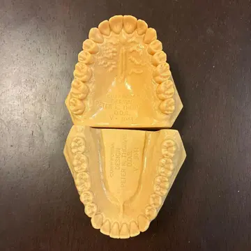 치과 모형 P.K. 토마스 선생님의 이상 교합 치열 모형