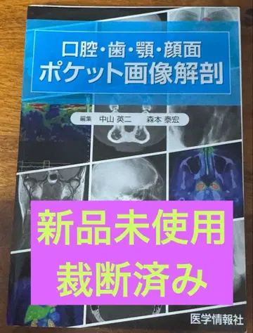 [재단됨] 구강 치아 턱 얼굴 포켓 이미지 해부