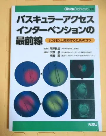 혈관 접근 중재술 최전선 3개월 이상 유지를 위한 비결