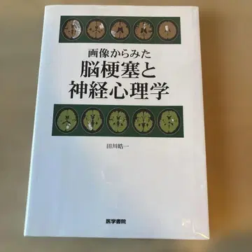 이미지로 본 뇌경색과 신경심리학