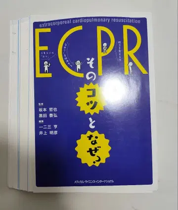 ECPR: 그 요령과 이유는?