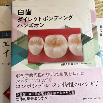 구치부 직접 본딩 핸즈온