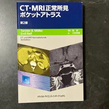 [ 재단 완료 최신 버전 ] CT MRI 정상 소견 포켓 아틀라스