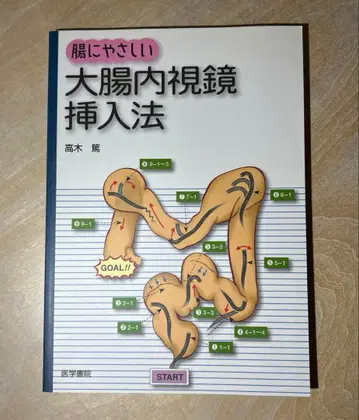 장에 부담 없는 대장내시경 삽입법