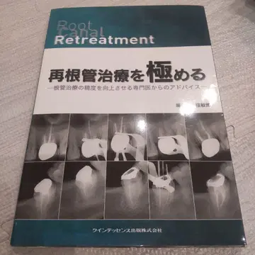재근관치료를 극하다: 근관치료의 정밀도를 향상시키는 전문가의 조언