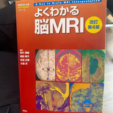 알기 쉬운 뇌 MRI 개정 제4판