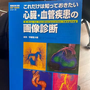 이것만은 알아두고 싶은 심혈관 질환의 이미지 진단