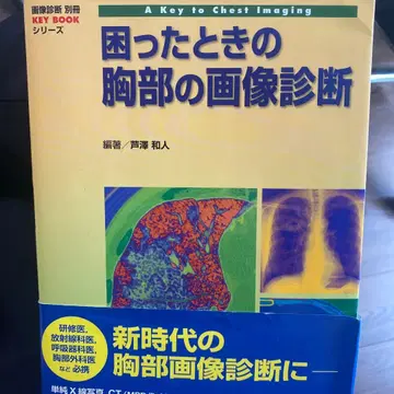 곤란할 때의 가슴 이미지 진단