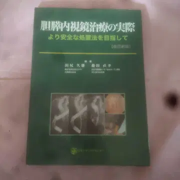 담췌내시경 치료의 실제: 보다 안전한 처치법을 목표로