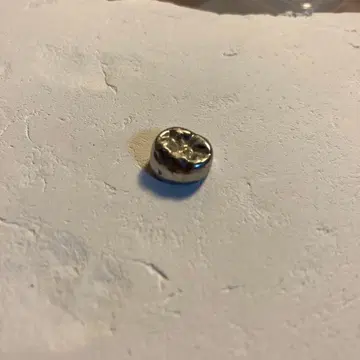 나의 은니 금속제 원형 액세서리