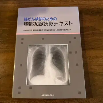 폐암 검진을 위한 흉부 X선 판독 텍스트