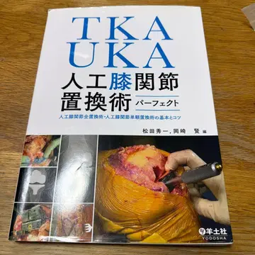 TKAU KA 인공 무릎 관절 치환술 퍼펙트