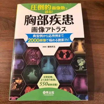 흉부 질환 이미지 아틀라스