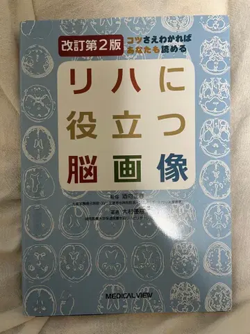 요령만 알면 당신도 읽을 수 있다 재활에 도움이 되는 뇌 이미지