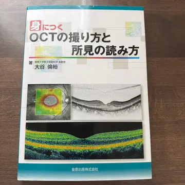 실무에 바로 적용하는 OCT 촬영법과 판독법