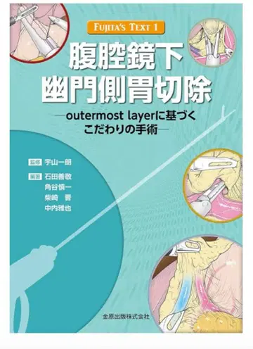 복강경하 유문부 위절제술