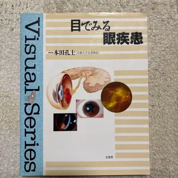 눈으로 보는 안과 질환