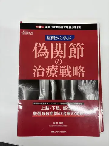 가관절 치료 전략 (재단됨)